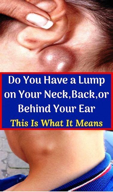 Do You Have a Lump on Your Neck,Back,or Behind Your Ear This Is What It Means (Causes of Lumps ...