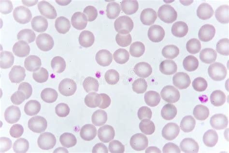 Platelets Microscope