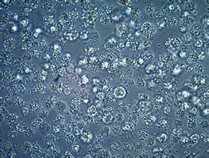 Cell Culture Contamination Troubleshooting