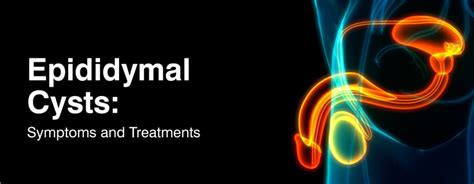 Epididymal Cysts: Symptoms and Treatments