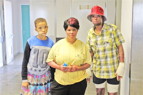 Skin transplants for gas explosion victims - The Namibian