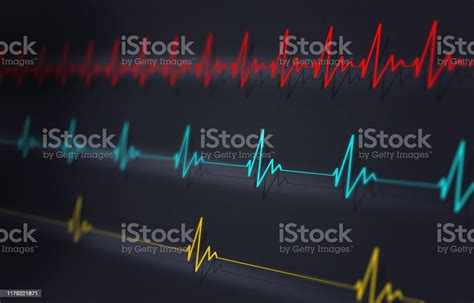 Fast Normal Slow Heartbeat Ecg Stock Illustration - Download Image Now - Electrocardiography ...