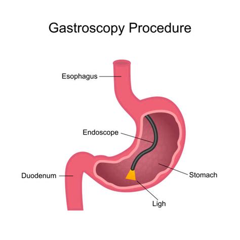 Female Digestive System Diagram Pics Illustrations, Royalty-Free Vector ...