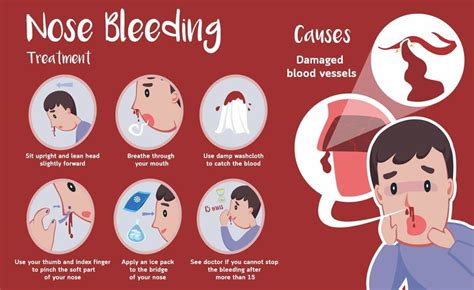 Nosebleeds (Epistaxis) in Children: Causes, Risk Factors, and How to Stop Them