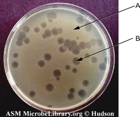 Isolation, Culture, and Identification of Viruses · Microbiology