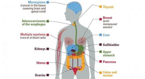 13 Types of Cancer Linked to Obesity, CDC Says - Cancer Health