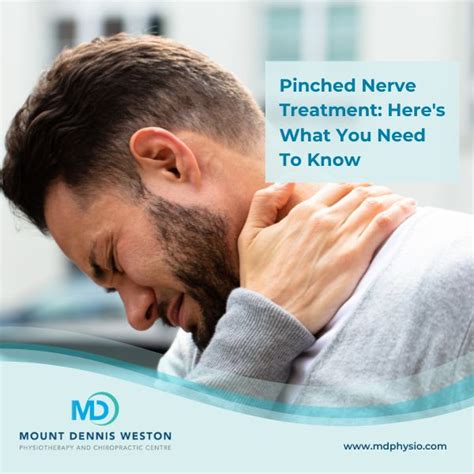 Pinched Nerve Treatment: What You Need to Know - Mount Dennis Weston Physiotherapy And Chiropractic