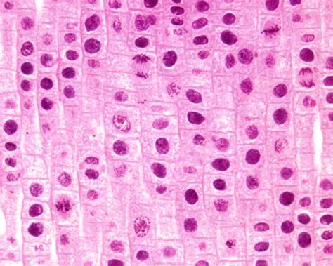 Stages Of Mitosis Under Microscope