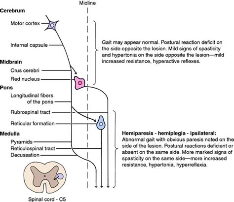 Why Does Upper Motor Neuron Lesion Cause Spasticity | Webmotor.org