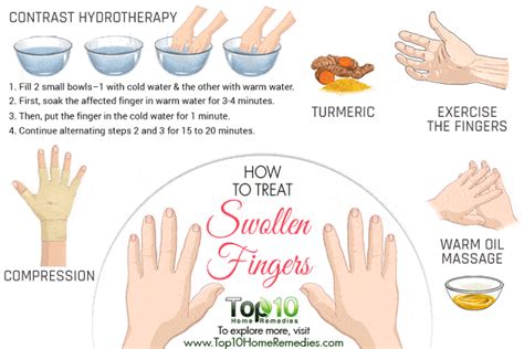 How to Treat Swollen Fingers | Top 10 Home Remedies