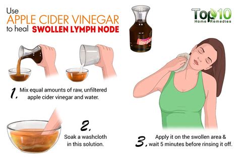 Home Remedies for Swollen Lymph Nodes | Top 10 Home Remedies