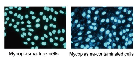 Mycoplasma Treatment Cell Culture - Pregnancy Informations