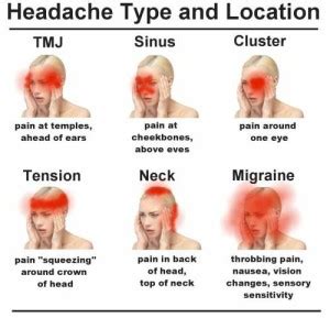 Neck Pain & Headaches - Dr. Allan Horowitz