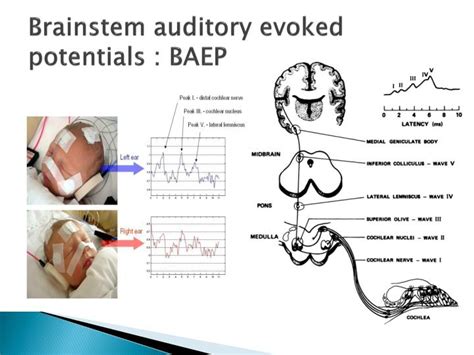 PPT - EEG brain for medical investigation and management PowerPoint Presentation - ID:2972430