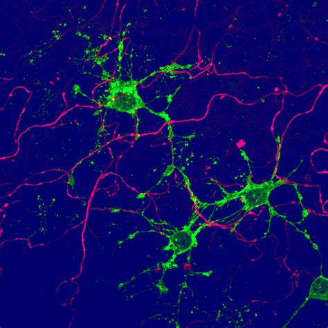 New glial cells discovered in the brain: Implications for brain repair