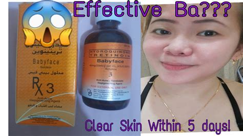 RDL BABYFACE SOLUTION #3 REVIEW | Clear Skin Within 5days | EFFECTIVE 😍 - YouTube