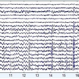 Example of an EEG Signal | Download Scientific Diagram