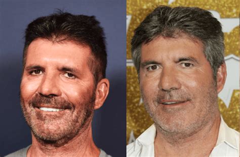 'AGT' Fans Shook: Is Simon Cowell's New Face Due To Vegan Diet Or Botox?