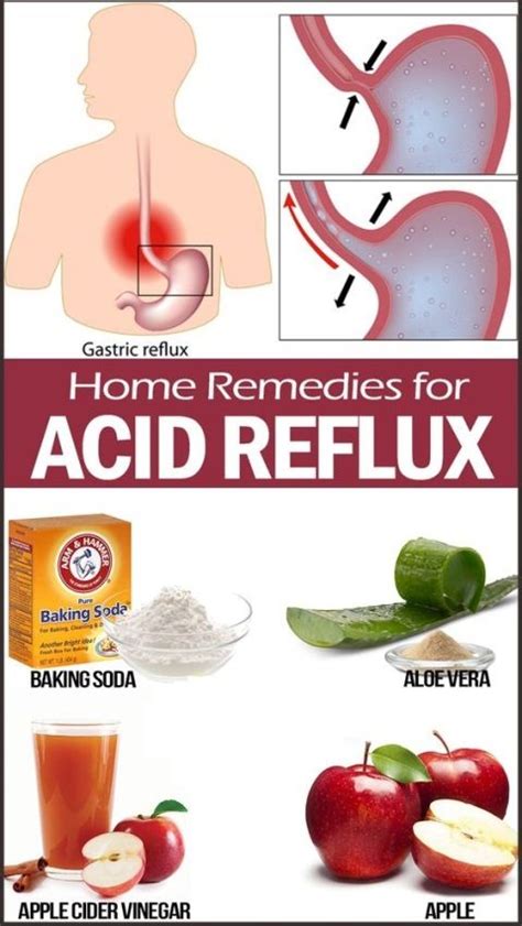 Some useful remedies for you to cut down on acid reflux