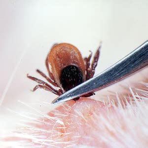 Tick Remover, Tick Removal Tool, Stainless Steel Tick Remover, Professional Tick Tweezers for ...