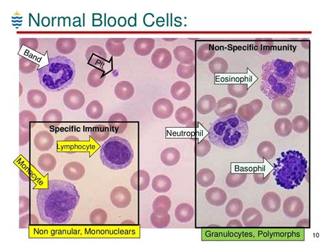 Pathology of WBC Disorders