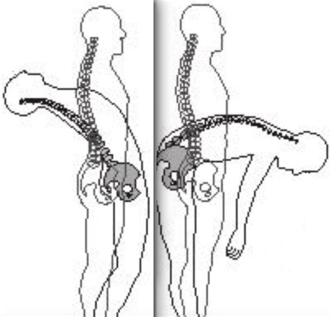 Why you can have lower back pain into extension and flexion | b-reddy.org