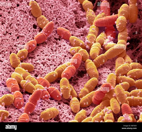 Streptococcus mutans bacteria hi-res stock photography and images - Alamy