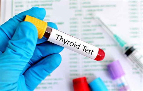 Thyroid blood test, thyroid function test, normal values & results ...