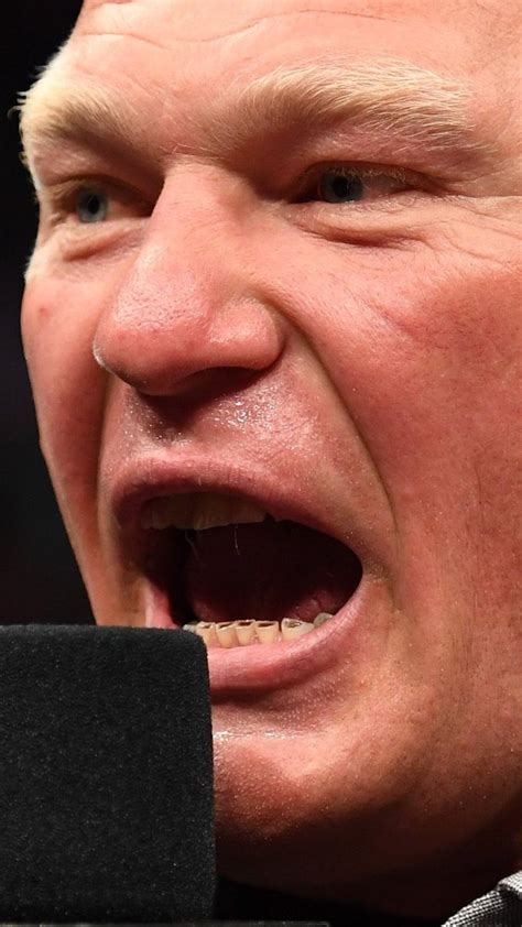 Gallery: Something Is Wrong With Brock Lesnar's Teeth - MMA Imports