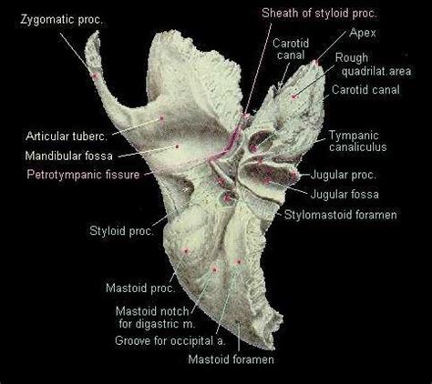 Temporal bone