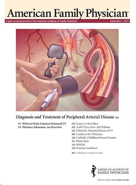 IDSA Updates Guideline for Managing Group A Streptococcal Pharyngitis ...