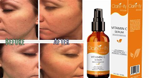 This Vitamin C Serum Might Be The Best Thing To Ever Happen To Your Skin