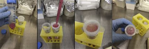 Removal of large debris Post-digestion filtering through a 70 mm cell... | Download Scientific ...