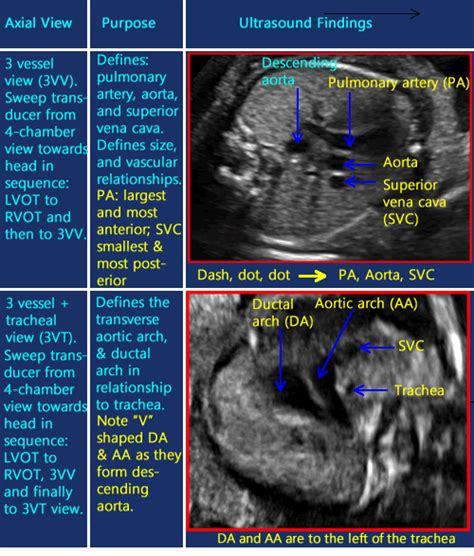 OB Images