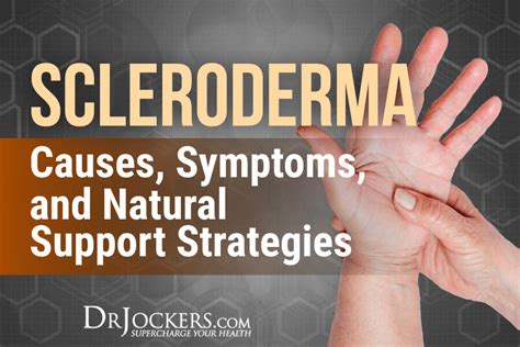 Scleroderma: Causes, Symptoms and Natural Support Strategies