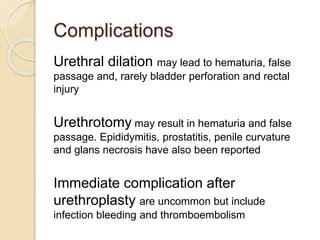 Management of anterior urethral stricture by AUA 2014 | PPT