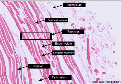 skeletal-muscles-slide-labelled-histology | Online Homework Help ...