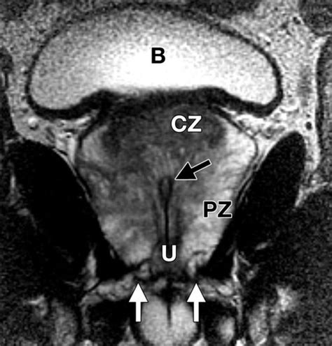 cama Persona a cargo del juego deportivo cama prostate mri anatomy ciervo audición Peculiar