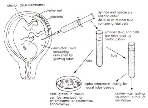 Amniocentesis Diagnostic Procedure Template