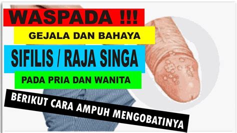 Gejala Penyebab Dan Pengobatan Infeksi Menular Seksual Sifilis (Raja ...