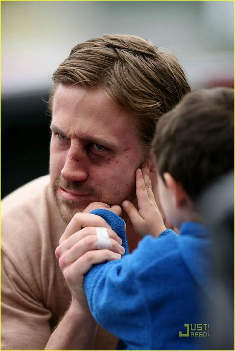 Ryan Gosling Gets A Black Eye: Photo 1906841 | Ryan Gosling Pictures | Just Jared