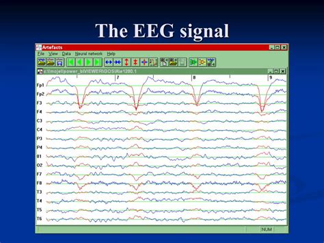 PPT - Basis of the M/EEG signal PowerPoint Presentation, free download ...