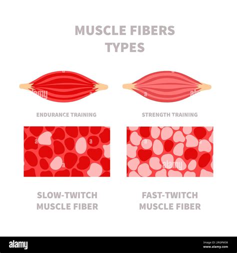 Skeletal muscle fiber types with slow twitch and fast twitch infographics. Red and white ...