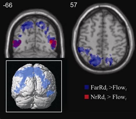 Activation in superior parietal lobe, inferior parietal sulcus and... | Download Scientific Diagram