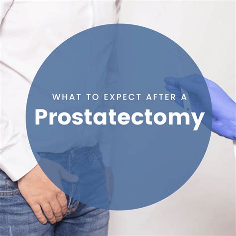 What to Expect After a Prostatectomy | New York City | 1 Prostate Center