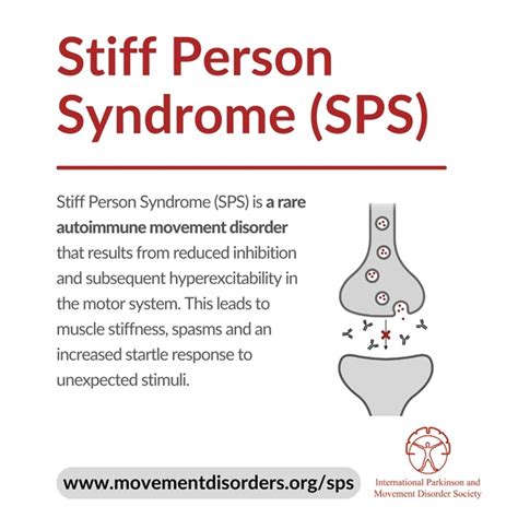 Stiff-person syndrome - SabineBowie