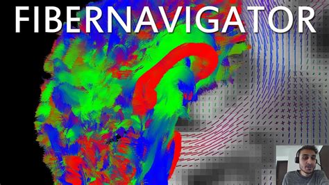 [DEMO] Real-time tractography and visualization tutorial using the ...