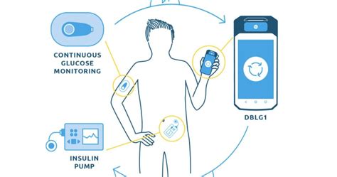 CGMs and Insulin Pump Integration A Perfect Combo Med Supply