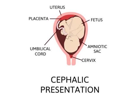 Cephalic Presentation of Baby During Pregnancy