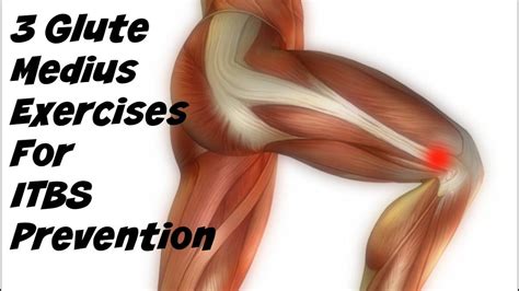 3 Glute Medius Exercise To Prevent ITB Syndrome - YouTube | Glute ...